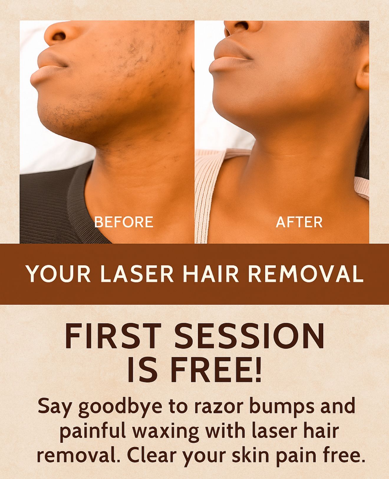 Before-and-after laser hair removal on a person's chin and neck. Text: