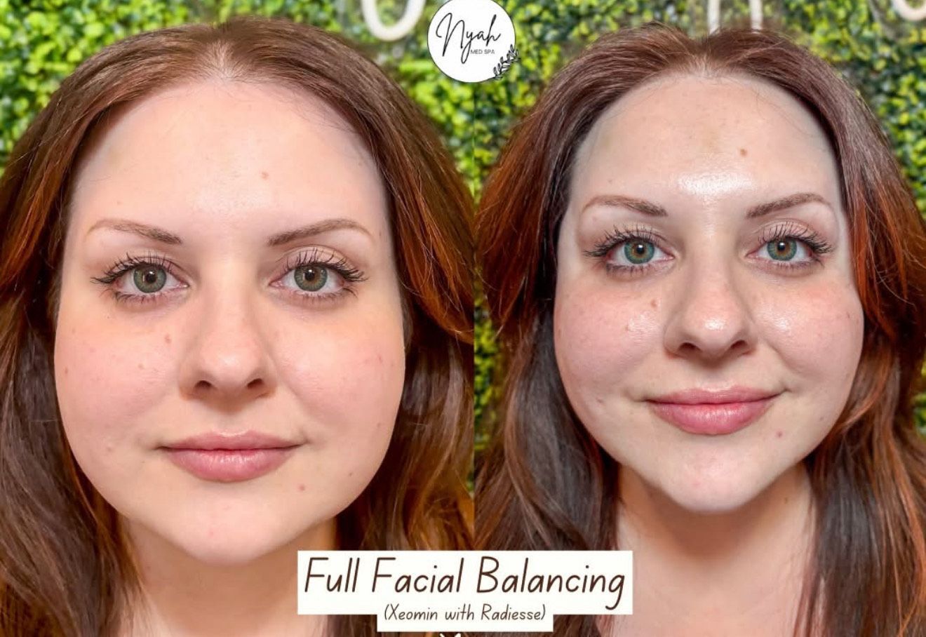 Side-by-side comparison of a person's face. The right side shows a different facial appearance.