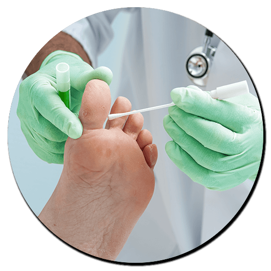 foot treatment experts