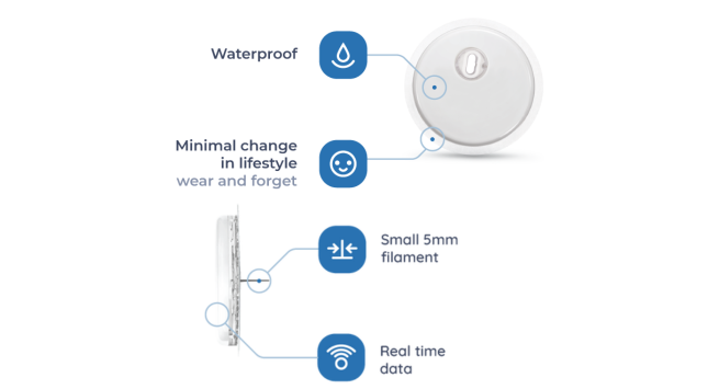 CGM schematic