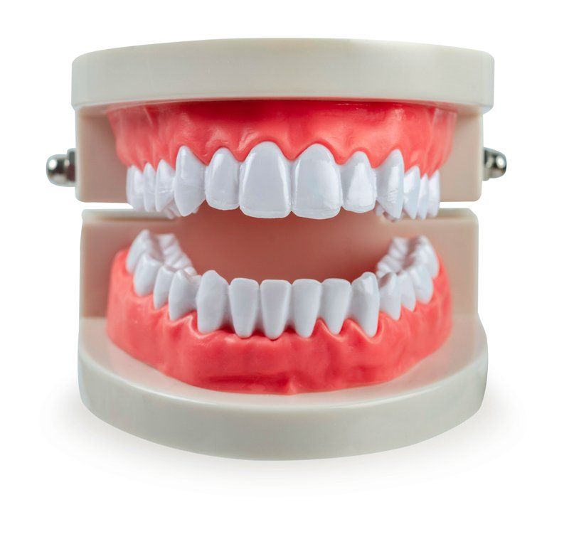 Dental Teeth Model — Brisbane, QLD — Everton Park Denture Clinic
