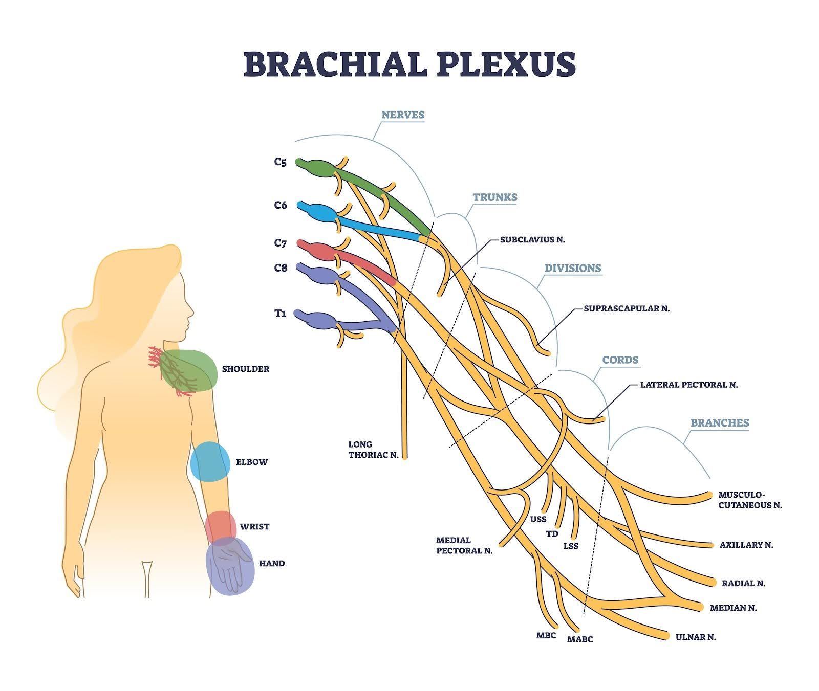 Diagram showing the brachial plexus nerves, with colored sections and a silhouette indicating areas served: shoulder, elbow, forearm, hand.