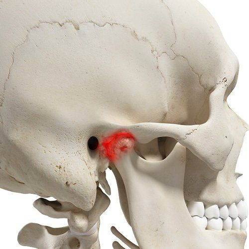 Distúrbios temporomandibulares - Distúrbios da boca e dos dentes - Manual  MSD Versão Saúde para a Família