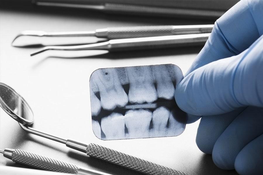 DIAGNÓSTICO RADIODENTAL URUAPAN - ATM