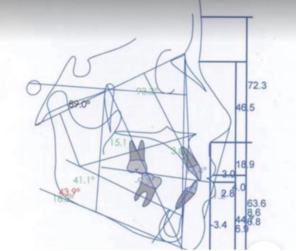 DIAGNÓSTICO RADIODENTAL URUAPAN - PA