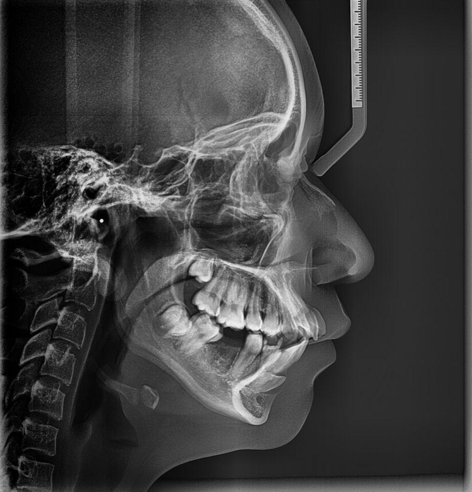 DIAGNÓSTICO RADIODENTAL URUAPAN - RADIOGRAFIA DE CRANEO