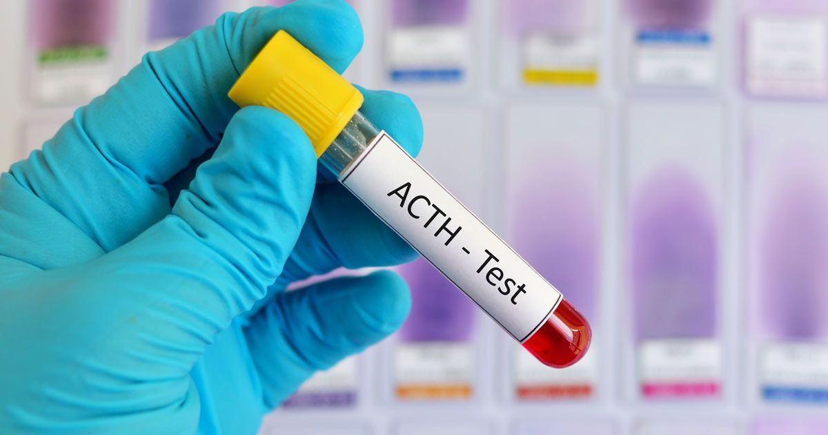A gloved hand holds a vial labeled ACTH Test use for Addisons Disease Treatments NYC by Dr. John Salerno