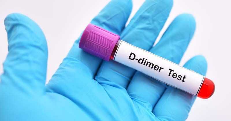 Gloved hand holding a blood test tube labeled 