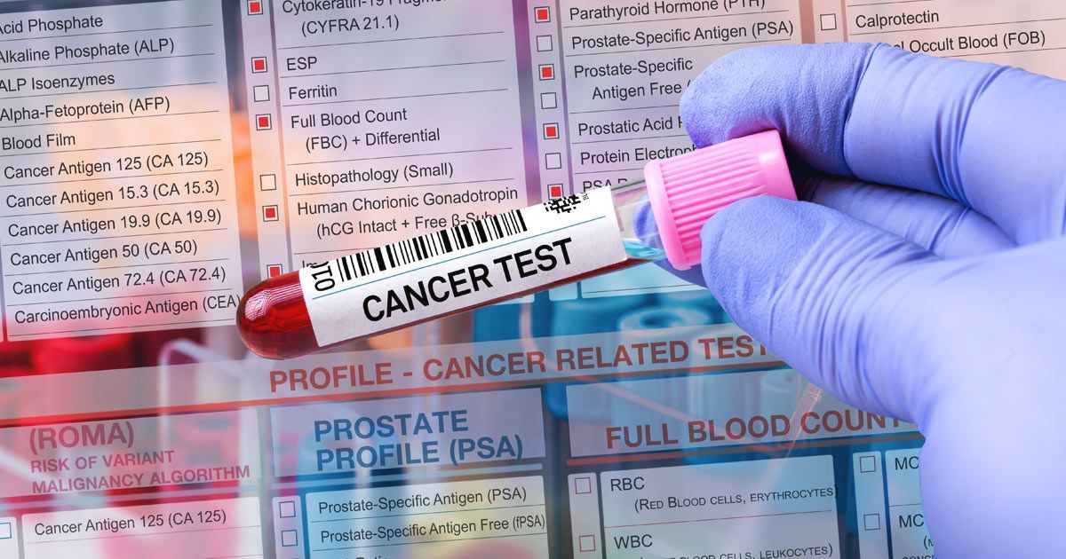A person is holding a test tube with a label that says Advanced Cancer Screening Test NYC - Dr. John Salerno
