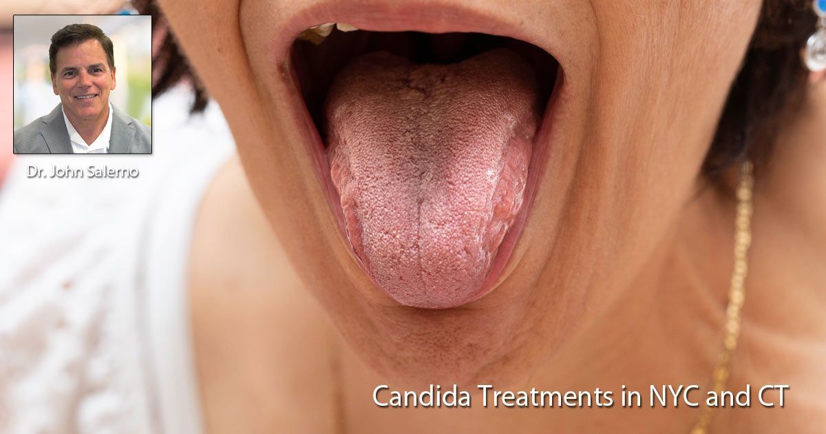 Candida Treatments NYC - Dr. John Salerno