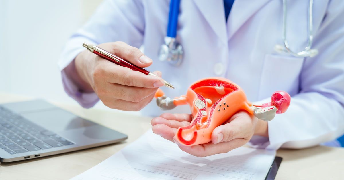 A doctor in a white coat points to a model of a female reproductive system. The model is held over a desk with a laptop representing Endometriosis Treatments NYC