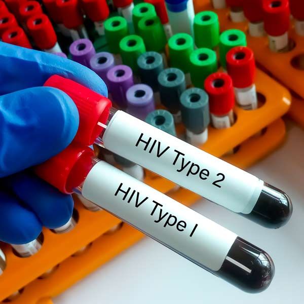 A hand holding two test tubes labeled hiv type 2 and hiv type 1 for HIV Treatments