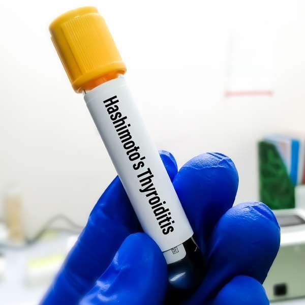 Immune System Treatments NYC