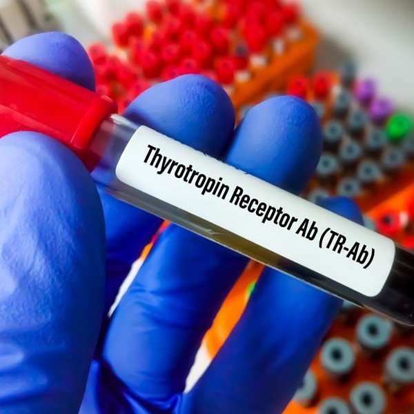 Thyrotropin receptor Ab (TR-Ab) to test and diagnose Hashimoto's thyroiditis. Blood sample tube for Thyrotropin receptor Ab (TR-Ab) test. To diagnose Hashimoto's thyroiditis at the medical laboratory. Integrative and Functional Care for Hashimoto's Thyroiditis at Salerno Wellness in Manhattan, NY, and Connecticut