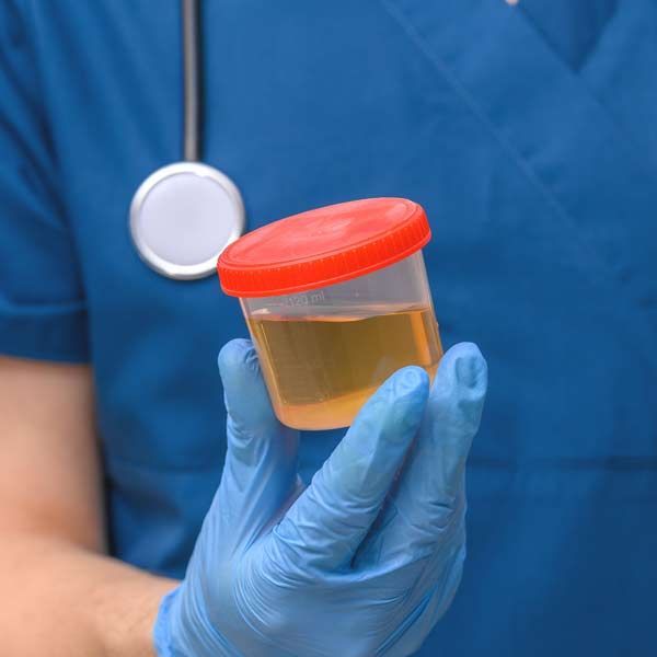 Medical professional holding a urine sample in a container, with a stethoscope around their neck.