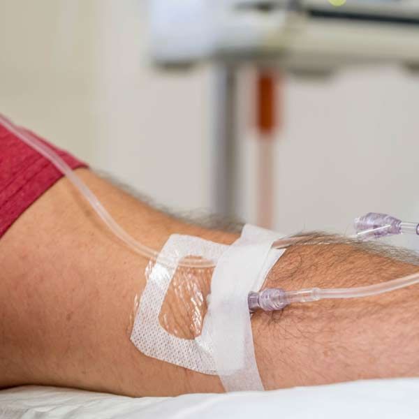 A Man Receiving an IV for Intravenous Immunoglobulin Treatments at Salerno Wellness in Manhattan, NY, and Connecticut