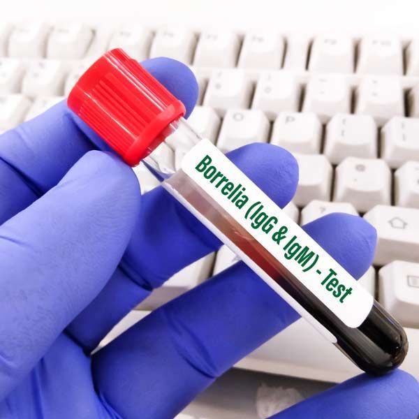 A person in blue gloves is holding a test tube that says