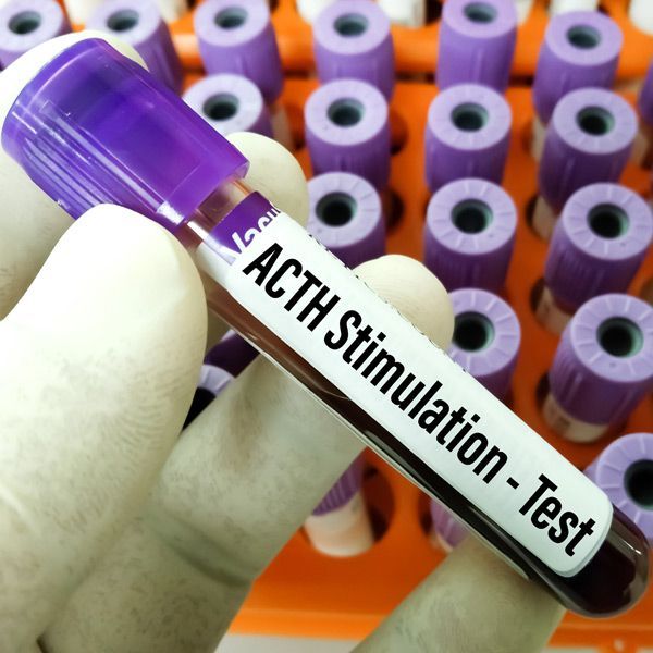 A person is holding a test tube that says ACTH stimulation test