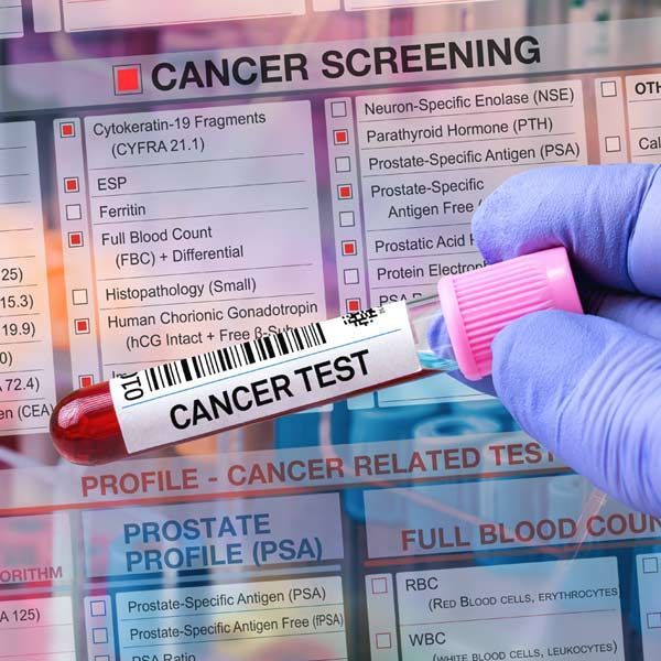 A person is holding a test tube that says cancer test for Advanced Cancer Screening Test