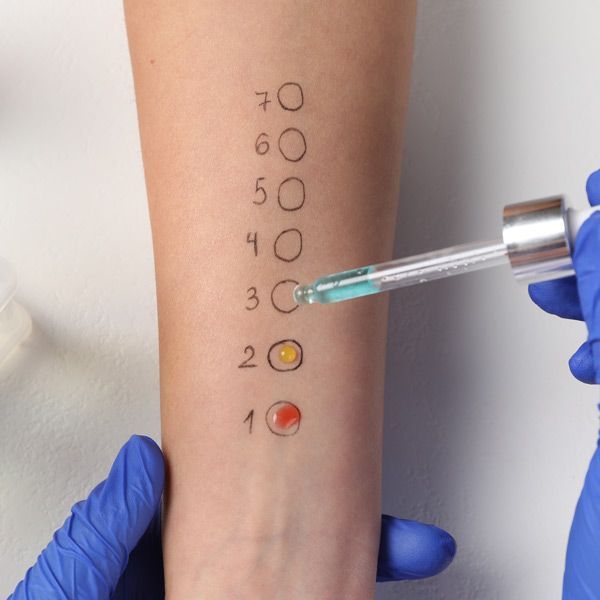 A person wearing blue gloves is applying a serum to a woman 's arm Allergy Testing