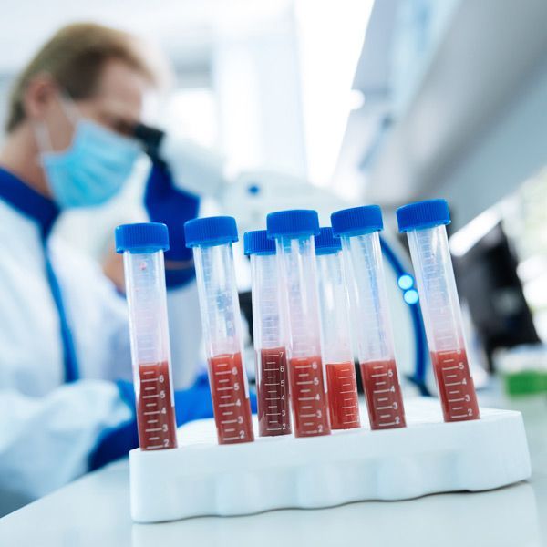 A row of test tubes with red liquid in them for Biological Age Testing
