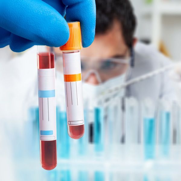 Blood in Vials Comprehensive Blood Testing