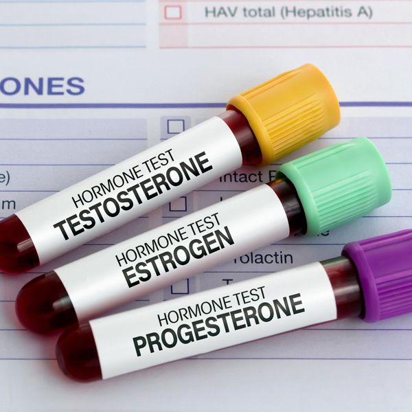 Three test tubes labeled testosterone, estrogen, and progesterone for Hormone Testing