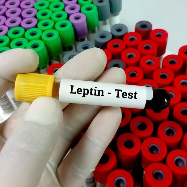 A person is holding a test tube that says leptin test for Leptin Challenge Test