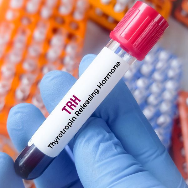 A person is holding a test tube that says TRH on it, representing TRH Stimulation Test (Thyrotropin-Releasing Hormone)