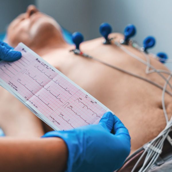 A person is holding a piece of paper with a heartbeat on it. EKG (Electrocardiogram)