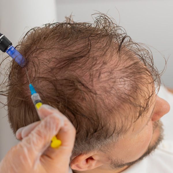 A man is getting an injection in his head with a syringe called Exosome Regenerative Treatment