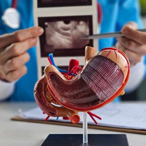 A doctor is examining a model of the stomach indicating Peptic Ulcer Treatments