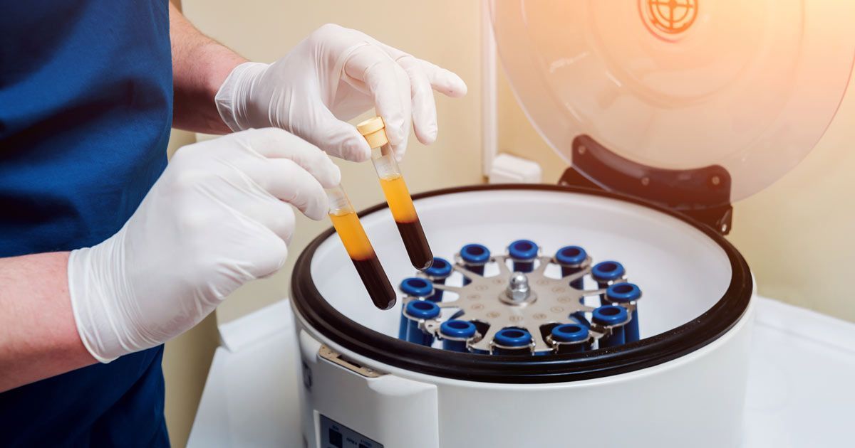 Nurse getting test tubes of Platelet-Rich Plasma Therapy NYC by Dr. John Salerno