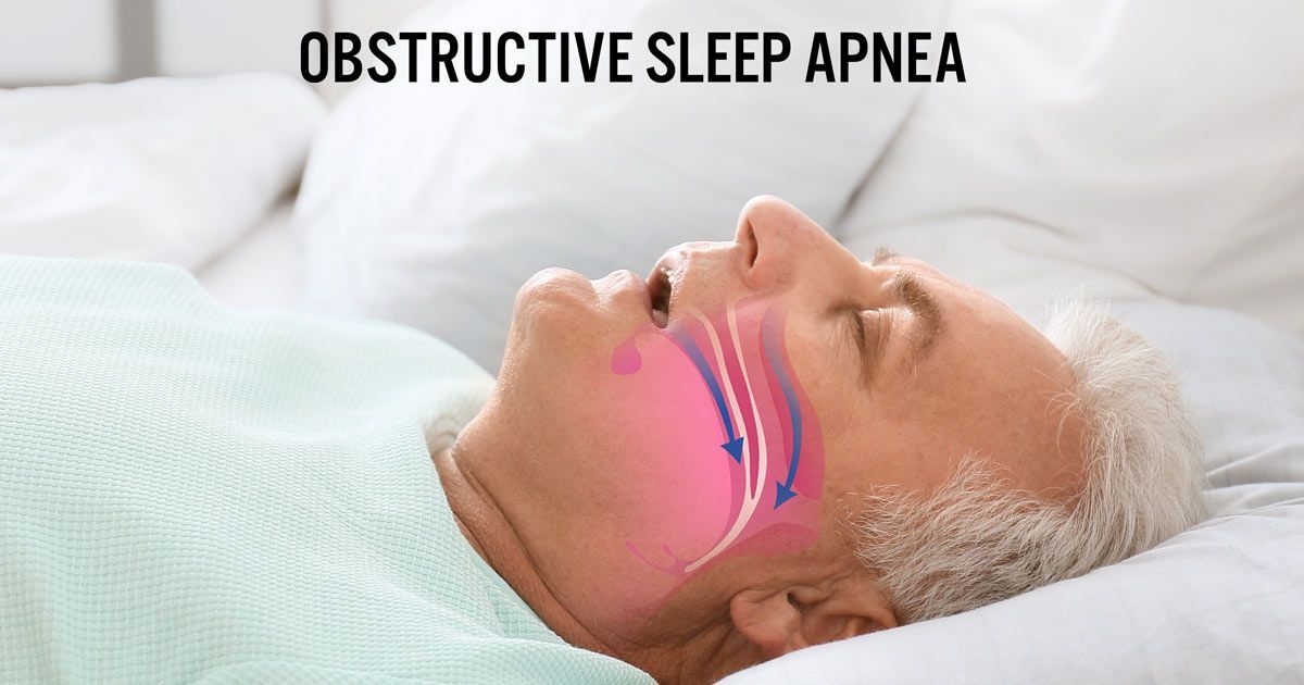 An elderly man is lying in bed with his mouth open, indicating Sleep Apnea Treatments NYC by Dr. John Salerno