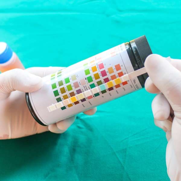 Hands in gloves holding a urine test strip next to a color chart for comparison as part of a yeast infection treatment