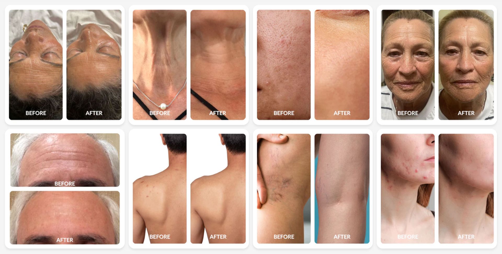 before and after images after light therapy Red Light Therapy NYC - Dr. John Salerno Phototherapy Treatments with Red and Blue Light at Salerno Wellness in Manhattan, NY and Connecticut
