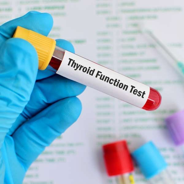 A person is holding a test tube that says thyroid function test for Integrative and Complementary Medical Care for Hypothyroidism at Salerno Wellness in Manhattan, NYC, and Connecticut