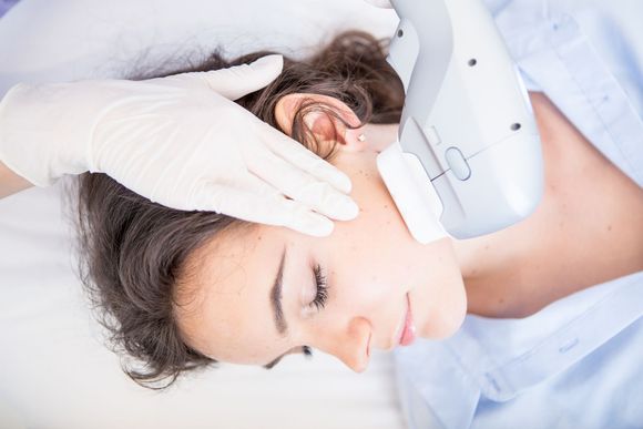 A Woman is Getting a Laser Treatment on Her Face — Bordentown, NJ — The Skin Medic