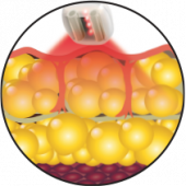 combatte le adiposità