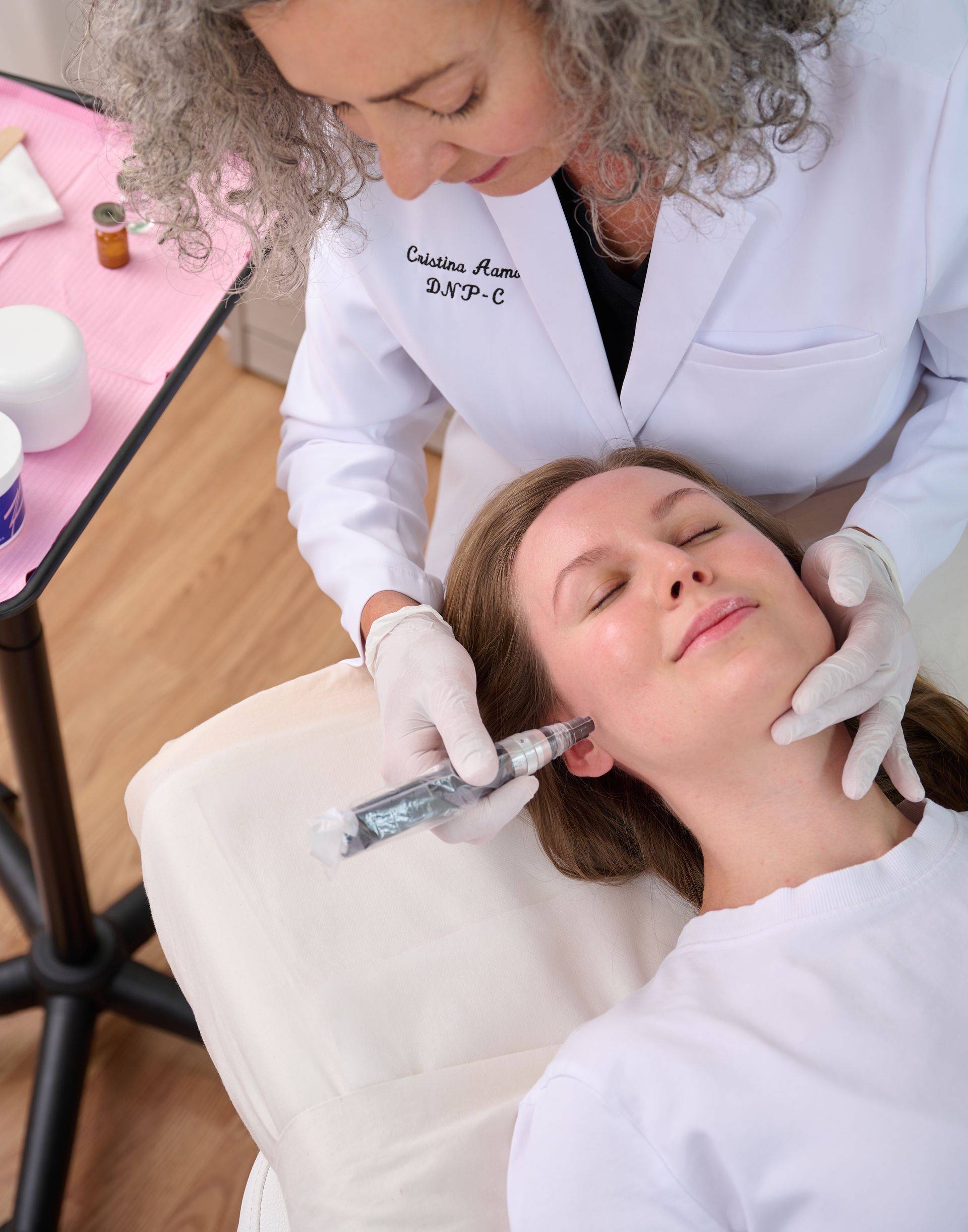Microneedling treatment