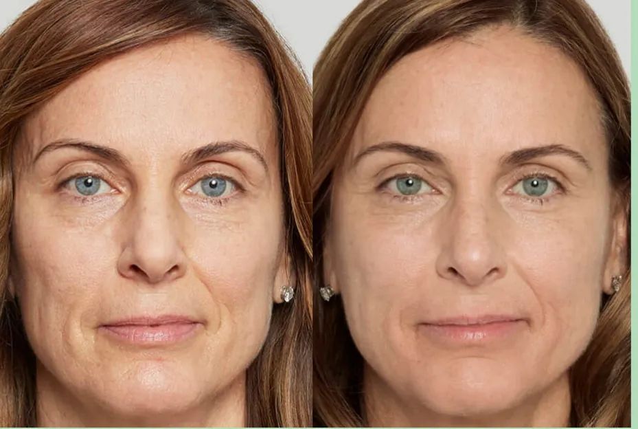 A before and after photo of a woman 's face.