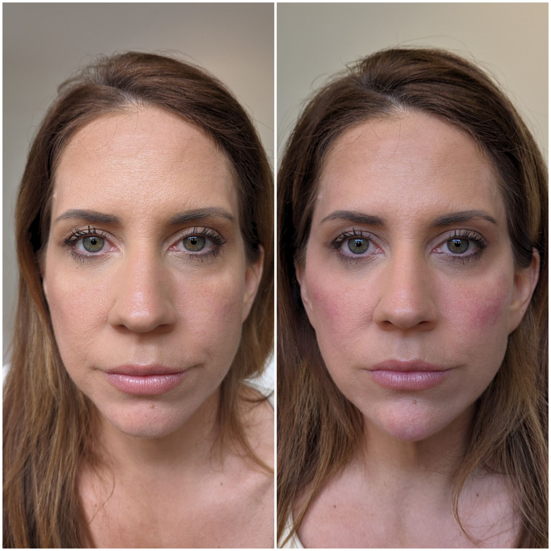 A before and after photo of a woman 's face.