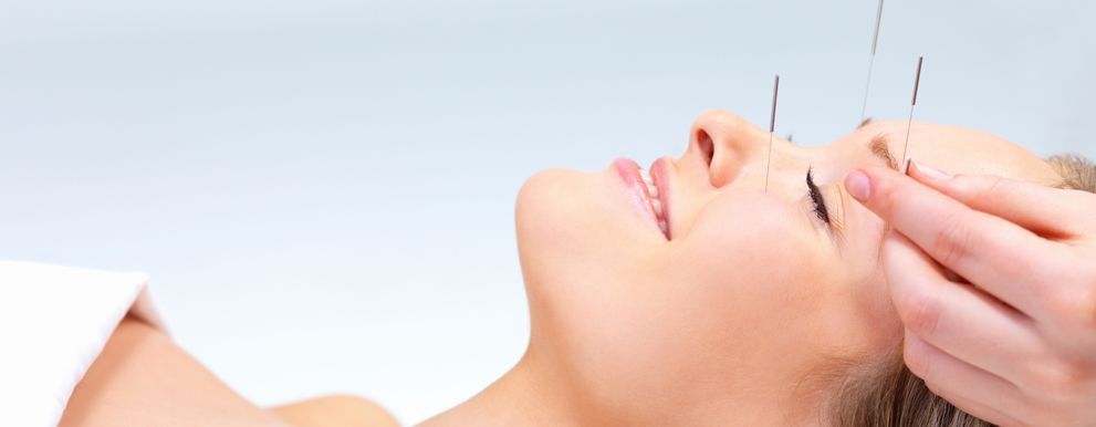 A woman is getting acupuncture on her face.