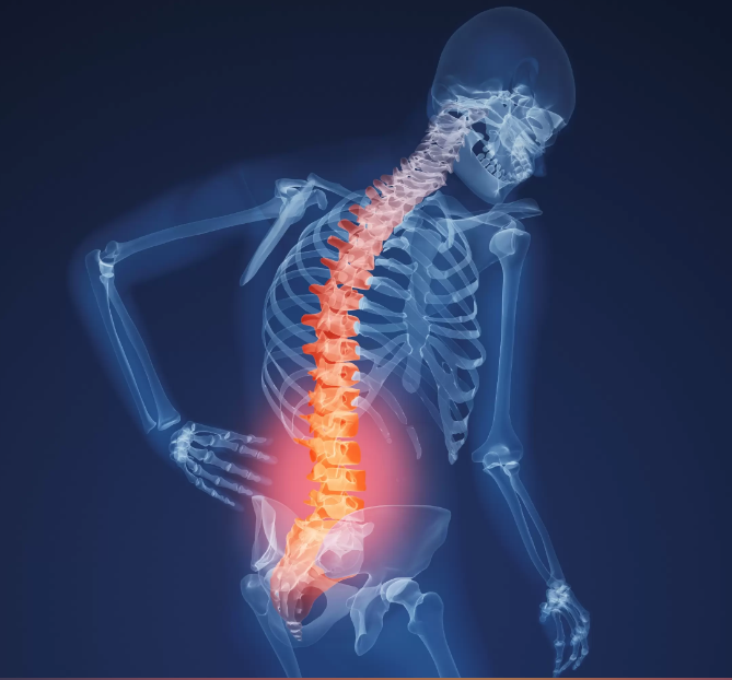 Runner Suffering from Lower Back Pain