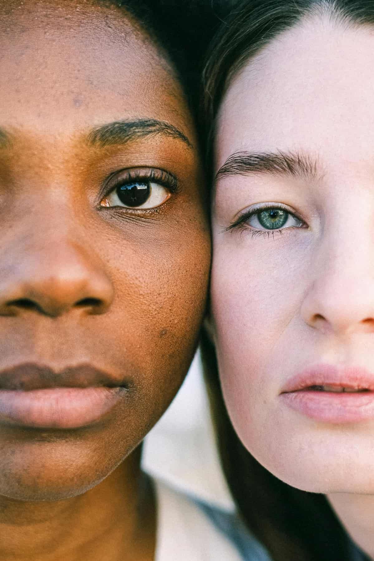 two rhinoplasty candidates