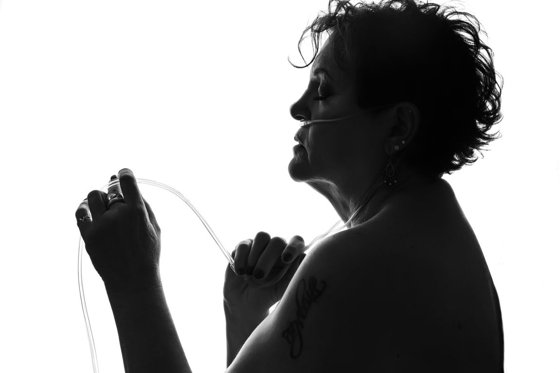 Female patient with oxygen tube.