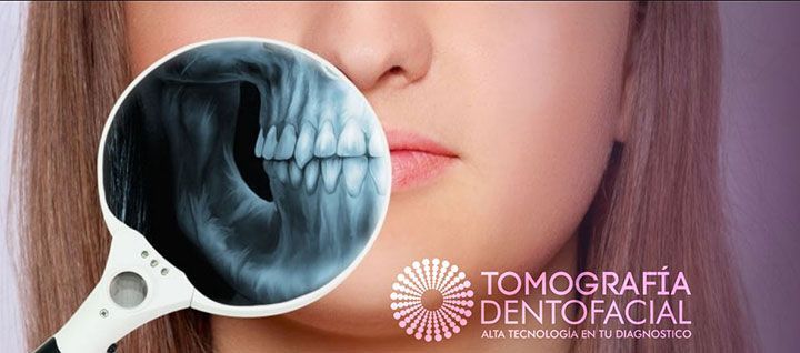 TOMOGRAFÍA DENTOFACIAL