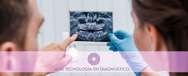 TOMOGRAFÍA DENTOFACIAL