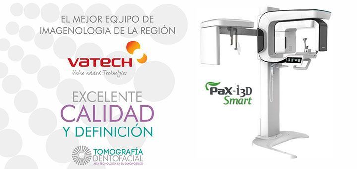 TOMOGRAFÍA DENTOFACIAL