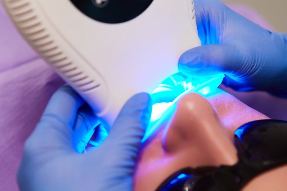 trattamento di sbiancamento dentale